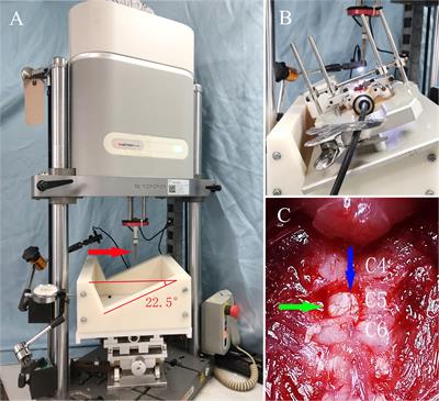 Neuroprotective Effect of Ketone Metabolism on Inhibiting Inflammatory Response by Regulating Macrophage Polarization After Acute Cervical Spinal Cord Injury in Rats